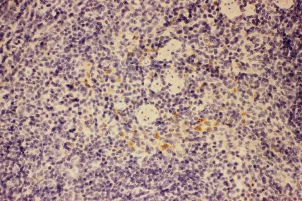 Anti-GM-CSF/CSF2 Antibody Picoband® Boster Bio