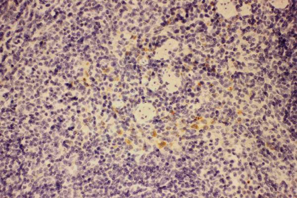 Anti-GM-CSF/CSF2 Antibody Picoband® Boster Bio