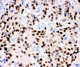 Anti-Progesterone Receptor/PGR Antibody Picoband® Boster Bio