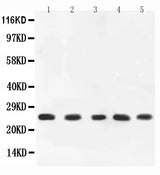 Anti-TNF alpha Antibody Picoband® Boster Bio