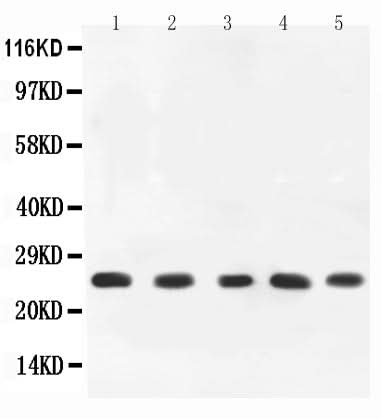 Anti-TNF alpha Antibody Picoband® Boster Bio