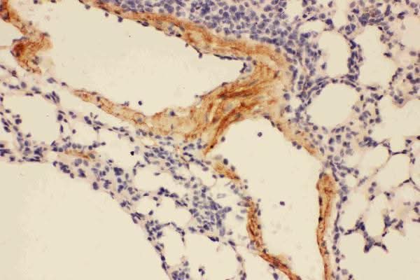 Anti-Adiponectin/ADIPOQ Antibody Picoband® Boster Bio