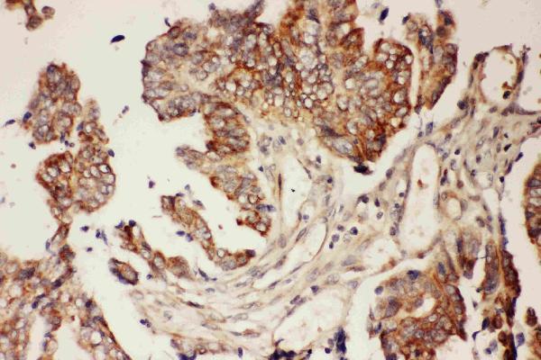 Anti-CNTF Antibody Picoband® Boster Bio