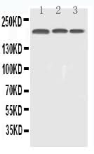 Anti-EGFR Antibody Picoband® Boster Bio