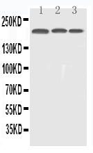 Anti-EGFR Antibody Picoband® Boster Bio