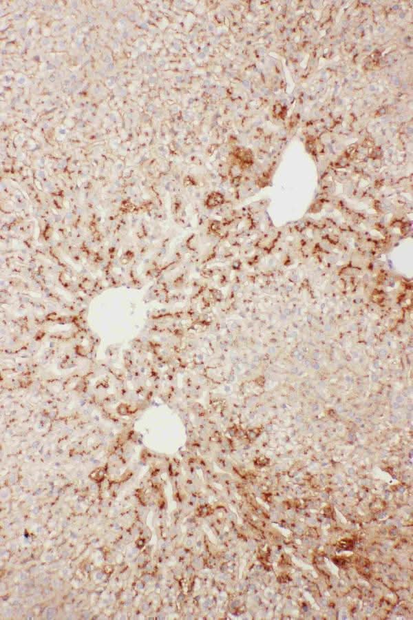 Anti-Serum Amyloid P/APCS Antibody Picoband® Boster Bio