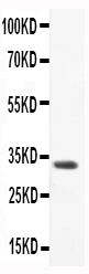 Anti-CCL3/Macrophage Inflammatory Protein 1 alpha Antibody Picoband® Boster Bio