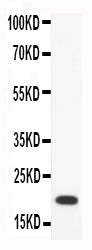 Anti-Macrophage Inflammatory Protein 4/CCL18 Antibody Picoband® Boster Bio