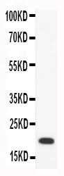 Anti-Macrophage Inflammatory Protein 4/CCL18 Antibody Picoband® Boster Bio