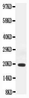 Anti-Interferon gamma/IFNG Antibody Picoband® Boster Bio