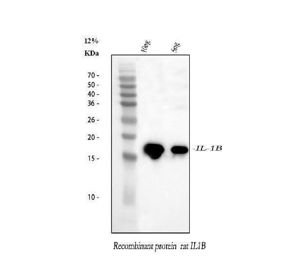Anti-IL1 beta/IL1B Antibody Picoband® Boster Bio