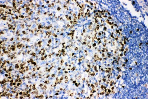 Anti-Ki67/MKI67 Antibody Picoband® Boster Bio