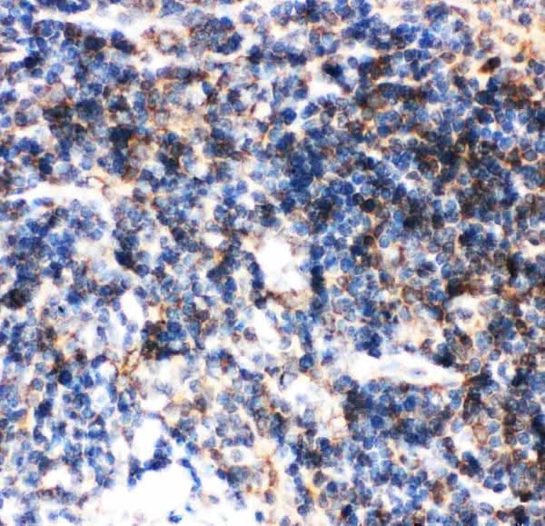 Anti-BID Antibody Picoband® Boster Bio