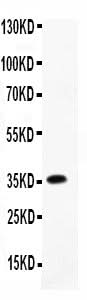 Anti-MCP3/CCL7 Antibody Picoband® Boster Bio