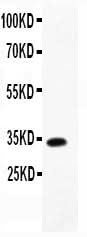 Anti-TARC/CCL17 Antibody Picoband® Boster Bio