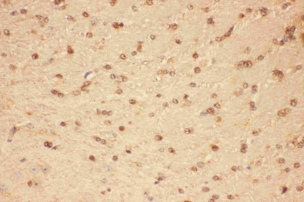 Anti-CNTF Antibody Picoband® Boster Bio
