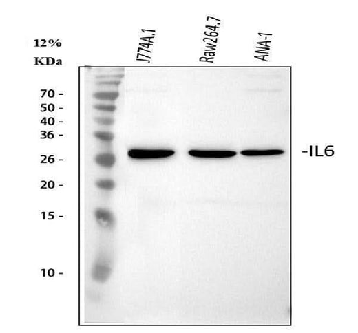 Anti-IL6 Antibody Picoband® Boster Bio