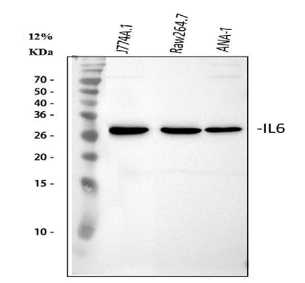 Anti-IL6 Antibody Picoband® Boster Bio
