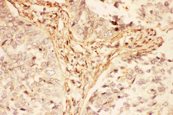Anti-LIF Antibody Picoband® Boster Bio