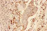 Anti-MMP7 Antibody Picoband® Boster Bio