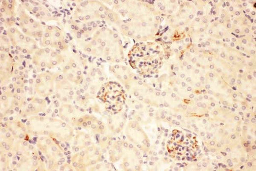 Anti-ACTH/POMC Antibody Boster Bio