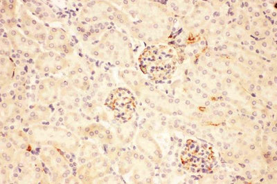 Anti-ACTH/POMC Antibody Boster Bio