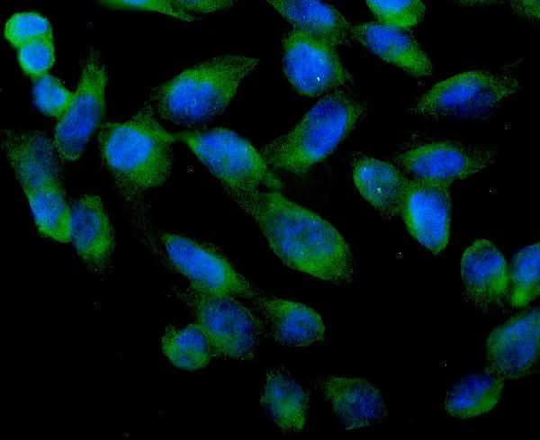 Anti-ARA9/AIP Antibody Picoband® Boster Bio