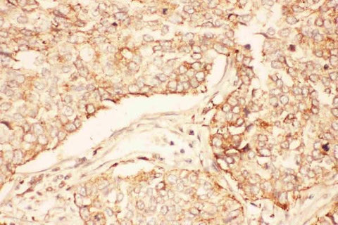 Anti-AKT2 Antibody Picoband® Boster Bio