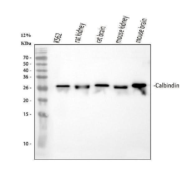 Anti-Calbindin/CALB1 Antibody Picoband® Boster Bio