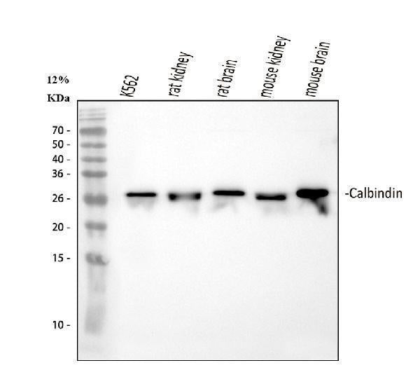 Anti-Calbindin/CALB1 Antibody Picoband® Boster Bio