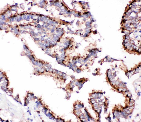 Anti-Cathepsin D/CTSD Antibody Picoband® Boster Bio