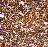 Anti-CD20/MS4A1 Antibody Picoband® Boster Bio
