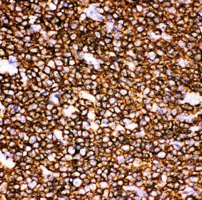 Anti-CD20/MS4A1 Antibody Picoband® Boster Bio