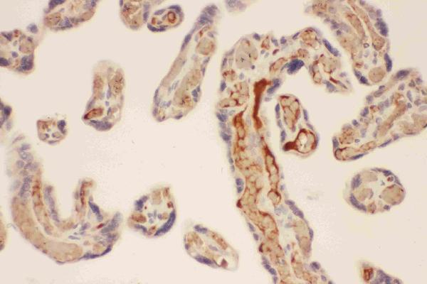 Anti-Mast Cell Chymase/CMA1 Antibody Picoband® Boster Bio