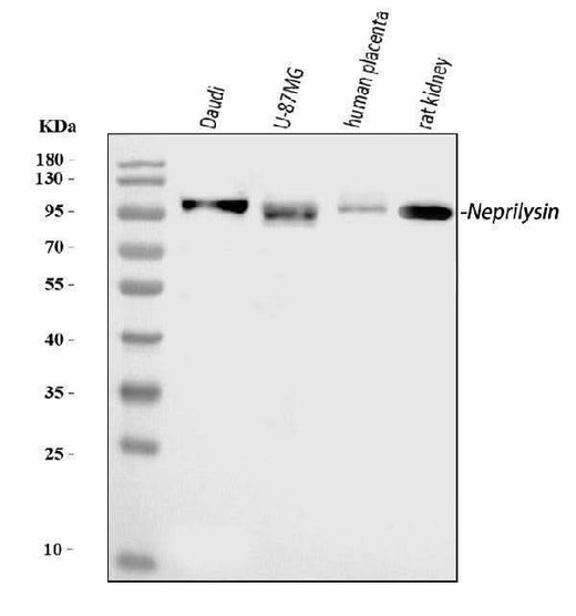 Anti-CD10/MME Antibody Picoband® Boster Bio