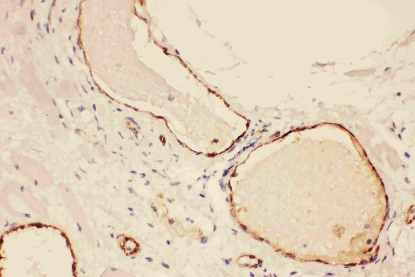 Anti-Von Willebrand Factor/VWF Antibody Picoband® Boster Bio