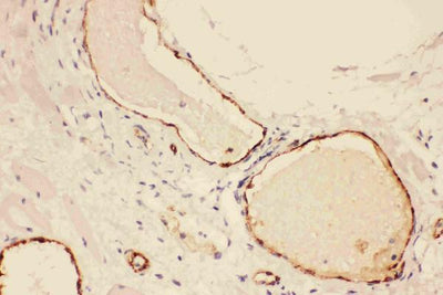 Anti-Von Willebrand Factor/VWF Antibody Picoband® Boster Bio