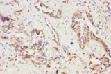 Anti-Eotaxin 3/CCL26 Antibody Picoband® Boster Bio
