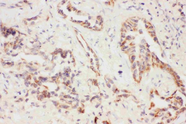 Anti-Eotaxin 3/CCL26 Antibody Picoband® Boster Bio