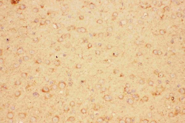 Anti-CNTF Antibody Picoband® Boster Bio