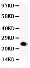 Anti-GDNF Antibody Picoband® Boster Bio