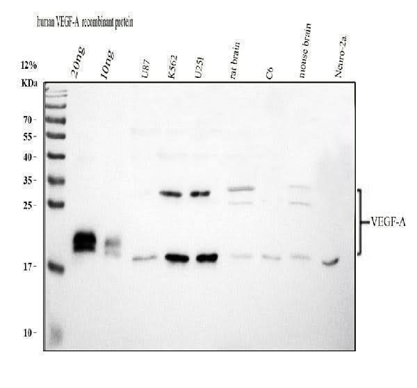 Anti-VEGF/VEGFA Antibody Picoband® Boster Bio