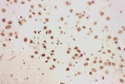 Anti-5 Lipoxygenase/ALOX5 Antibody Picoband® Boster Bio