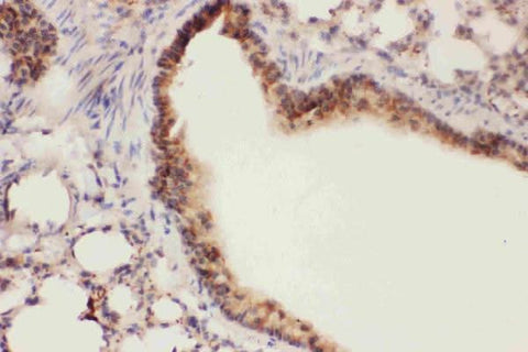 Anti-15 Lipoxygenase 1/ALOX15 Antibody Picoband® Boster Bio