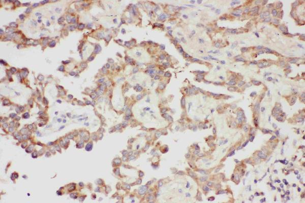 Anti-Galectin 3/LGALS3 Antibody Picoband® Boster Bio