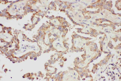 Anti-Galectin 3/LGALS3 Antibody Picoband® Boster Bio