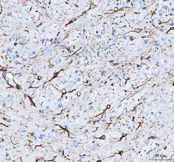 Anti-GFAP Antibody Picoband® Boster Bio