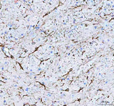 Anti-GFAP Antibody Picoband® Boster Bio