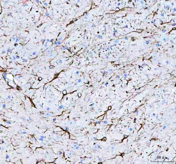 Anti-GFAP Antibody Picoband® Boster Bio