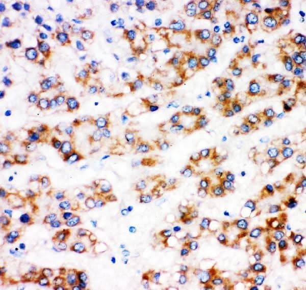 Anti-alpha 1 Fetoprotein/AFP Antibody Picoband® Boster Bio